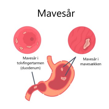 mavesaar figur