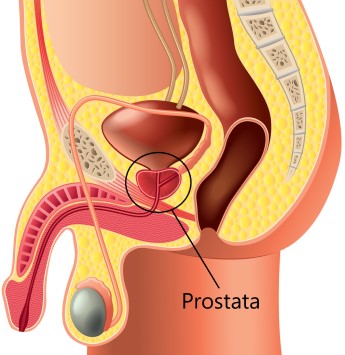 prostata